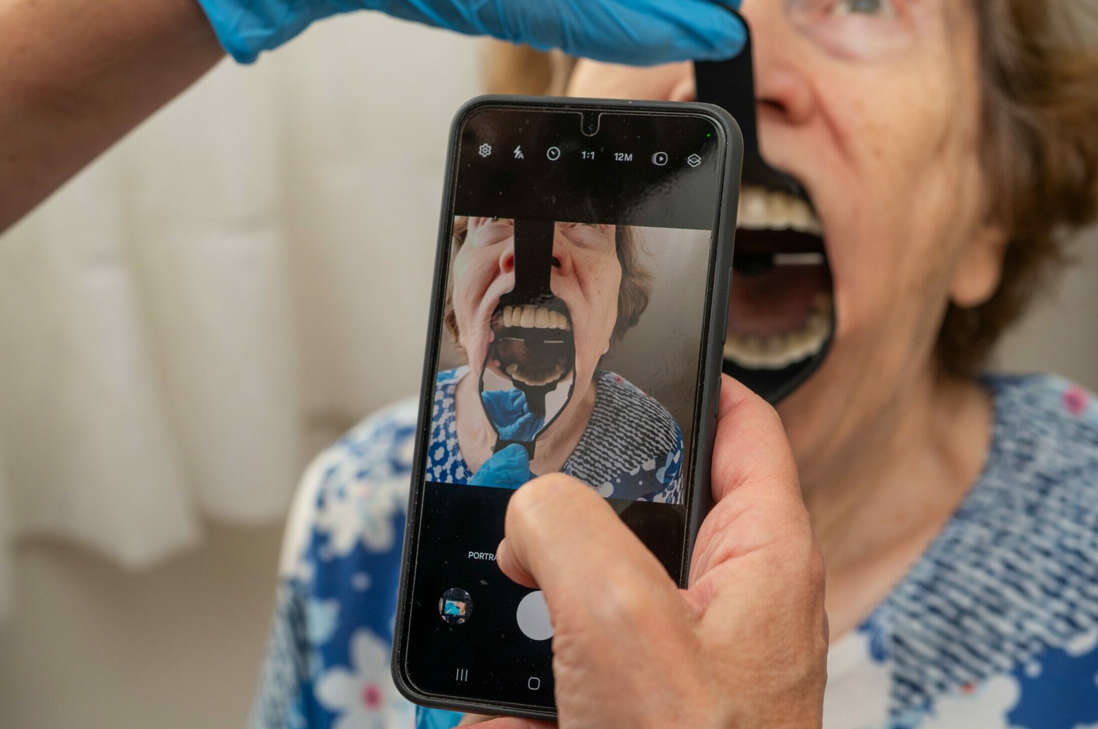 Soignant prenant une photo intraorale avec un smartphone en utilisant l’Odontoscope pour la téléexpertise